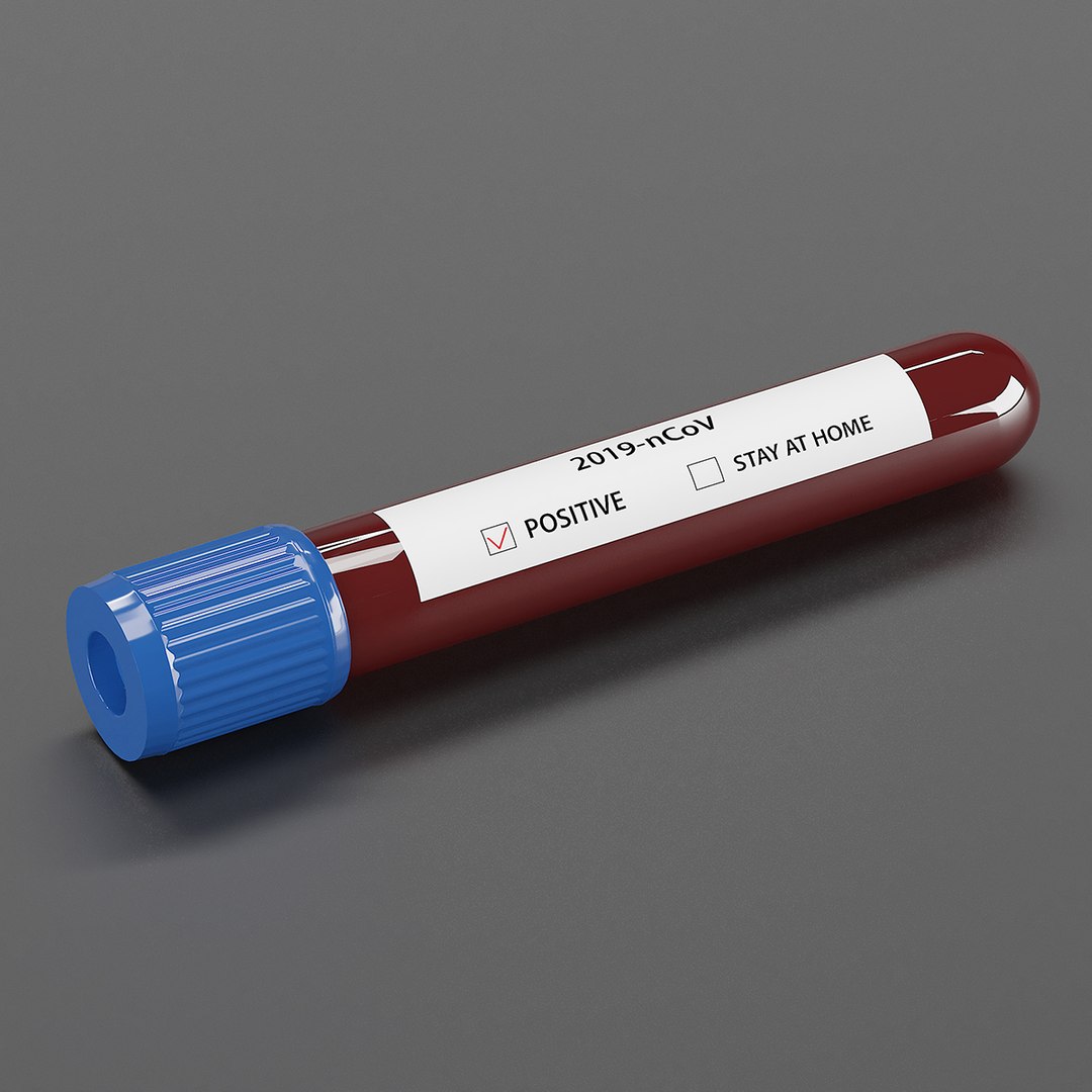 3D types coronavirus test tubes model https://p.turbosquid.com/ts-thumb/RJ/p1oxo9/D0eB8W7B/4/jpg/1587335133/1920x1080/fit_q87/f1a9e65b7abce131449ff5be8c8a5fb0e5573d47/4.jpg