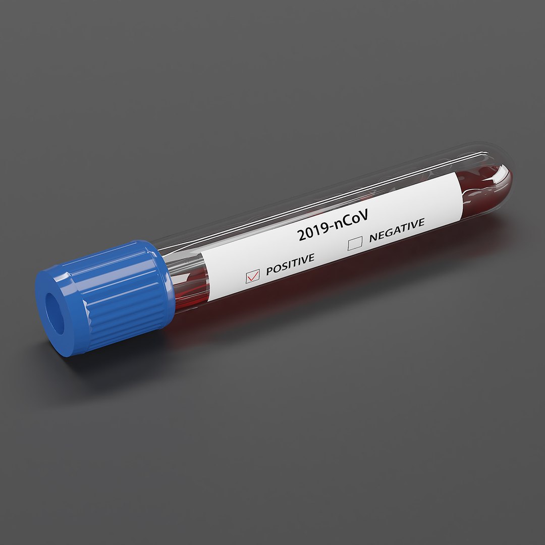 3D types coronavirus test tubes model https://p.turbosquid.com/ts-thumb/RJ/p1oxo9/PpTL0jnh/3/jpg/1587335119/1920x1080/fit_q87/100ddf02963e7bc84bf99f73984f4f34c18c9b67/3.jpg