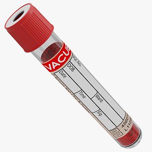 Test Tube with Blood