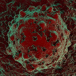 Wrecked Cell Microscope View