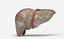 Liver Damage Stages