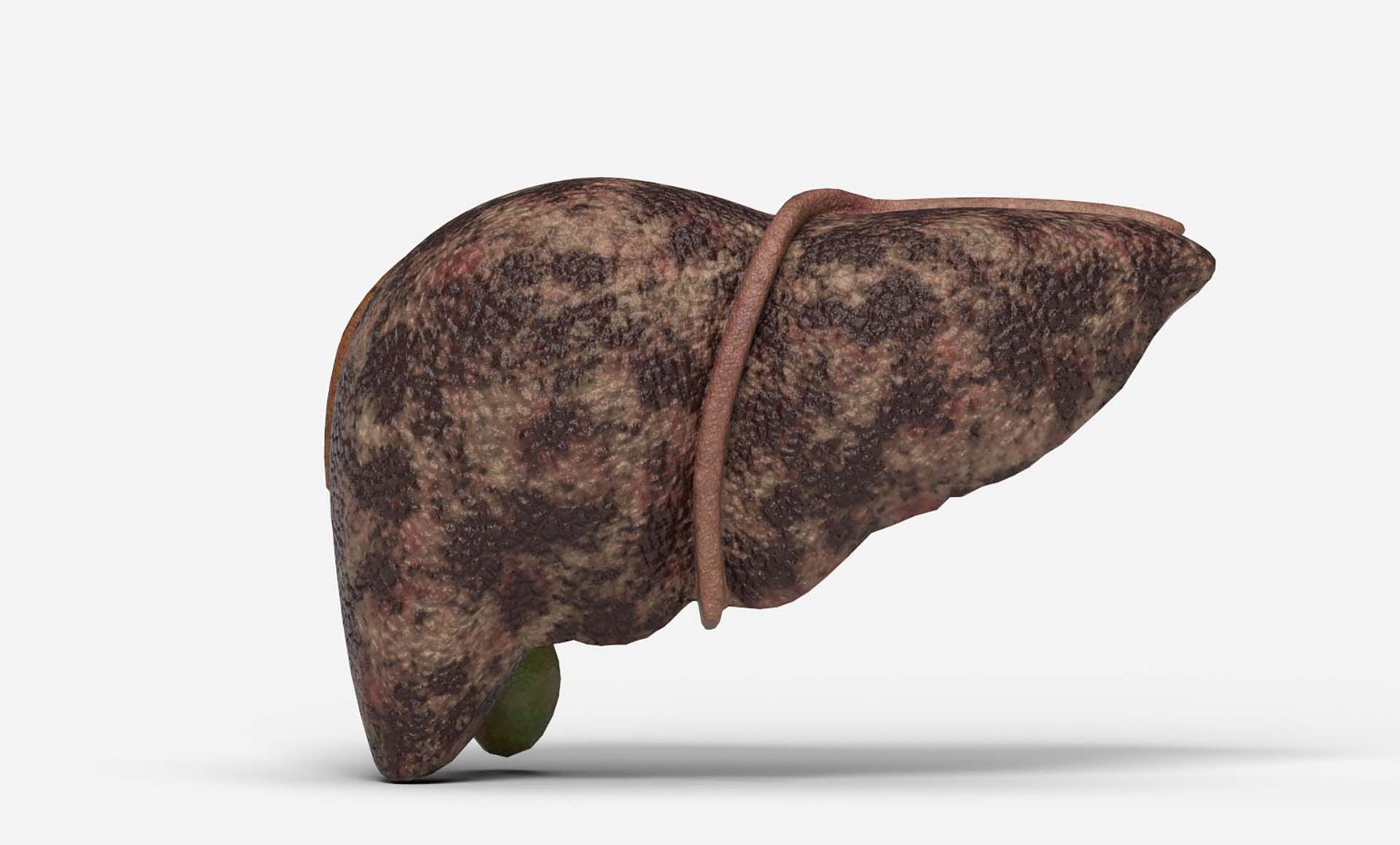 3D Liver Damage Stages https://p.turbosquid.com/ts-thumb/Ra/YEZMol/MQ/6/jpg/1761309221/1920x1080/fit_q87/569d76793a8866fca457e3a29d6f01ef836663b0/6.jpg