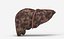 Liver Damage Stages