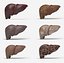 Liver Damage Stages