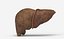 Liver Damage Stages