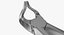 Forcep extrahieren