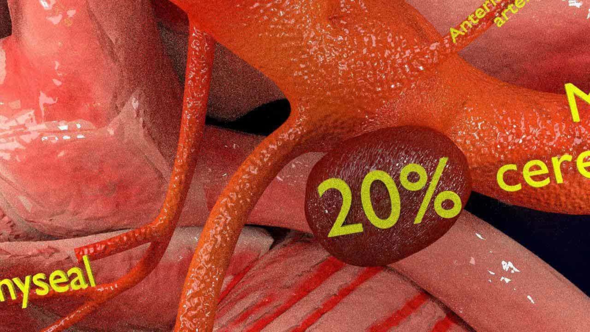 Cerebral aneurysms berry circle of willis 3D model https://p.turbosquid.com/ts-thumb/S0/8AcZxw/4D/8/jpg/1679588176/1920x1080/fit_q87/93c33991ff3805836cf1da6be81d17a22a226574/8.jpg