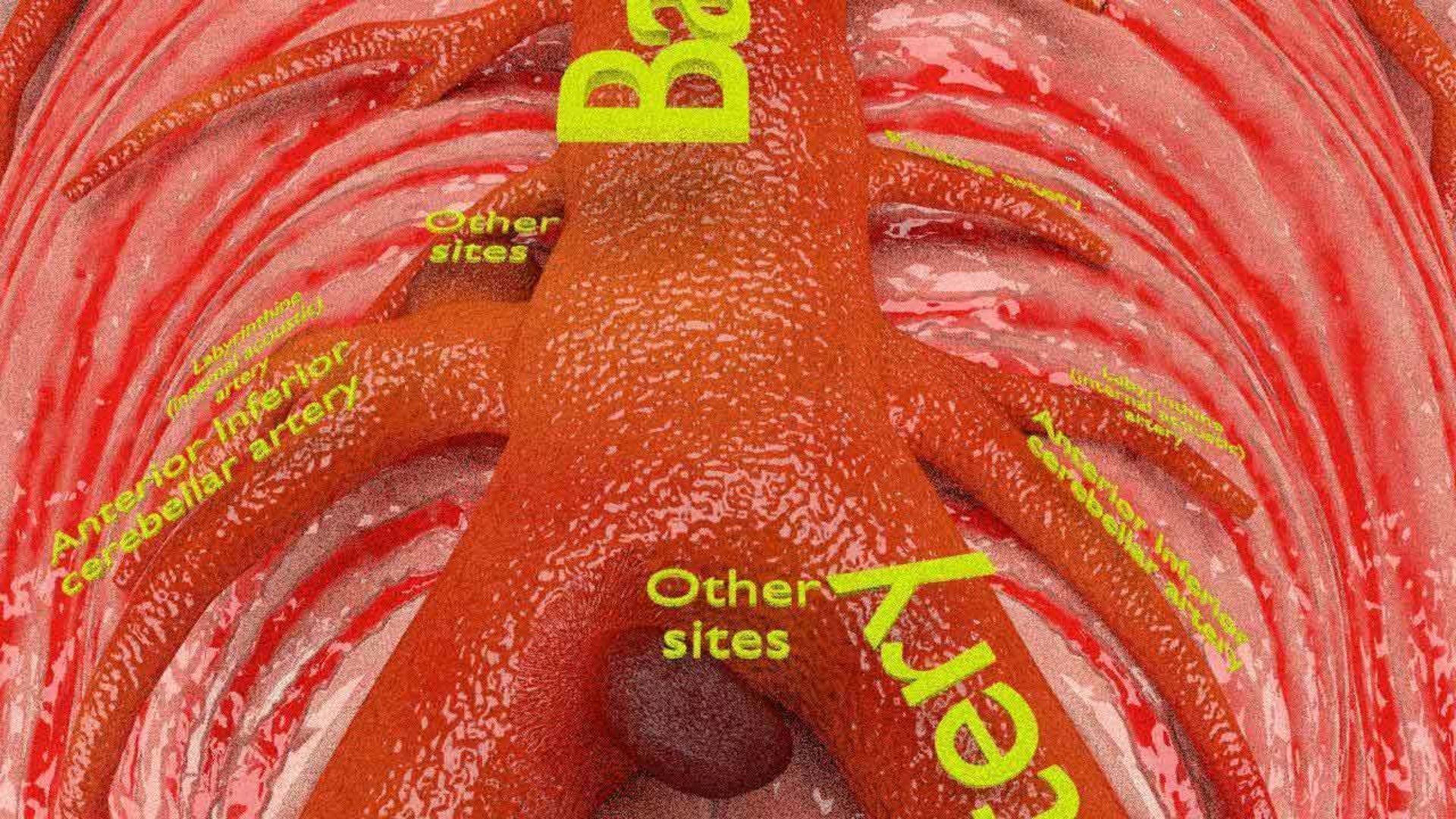 Cerebral aneurysms berry circle of willis 3D model https://p.turbosquid.com/ts-thumb/S0/8AcZxw/kG/3/jpg/1679588172/1920x1080/fit_q87/467c9ceaa4103a69f410849478746a1ebb073d30/3.jpg
