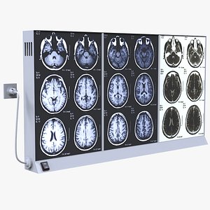 X-Ray Illuminator Light Box