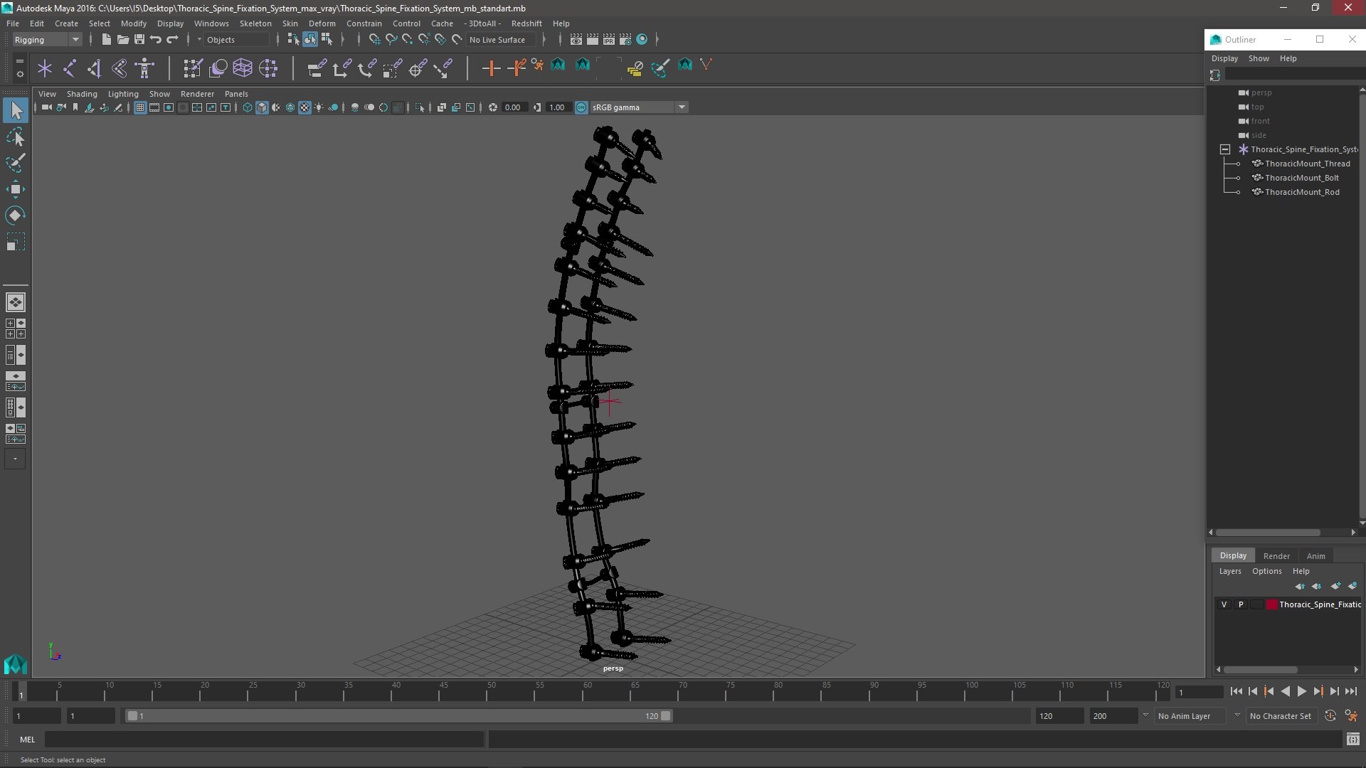 Thoracic Spine Fixation System 3D Model - TurboSquid 2206795