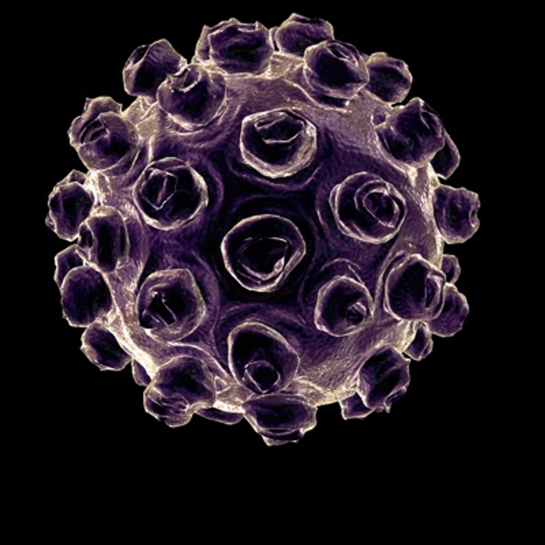 3d measles virus science model https://p.turbosquid.com/ts-thumb/SB/IuDnf0/vELZionn/1/jpg/1255363321/1920x1080/fit_q87/4d3e712df9702efc48a1357eb92ff1c8f670beb1/1.jpg