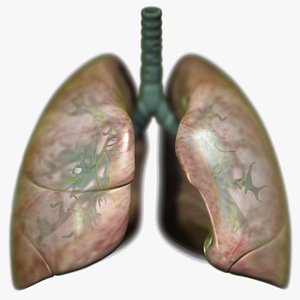 3D Lungs Scanline