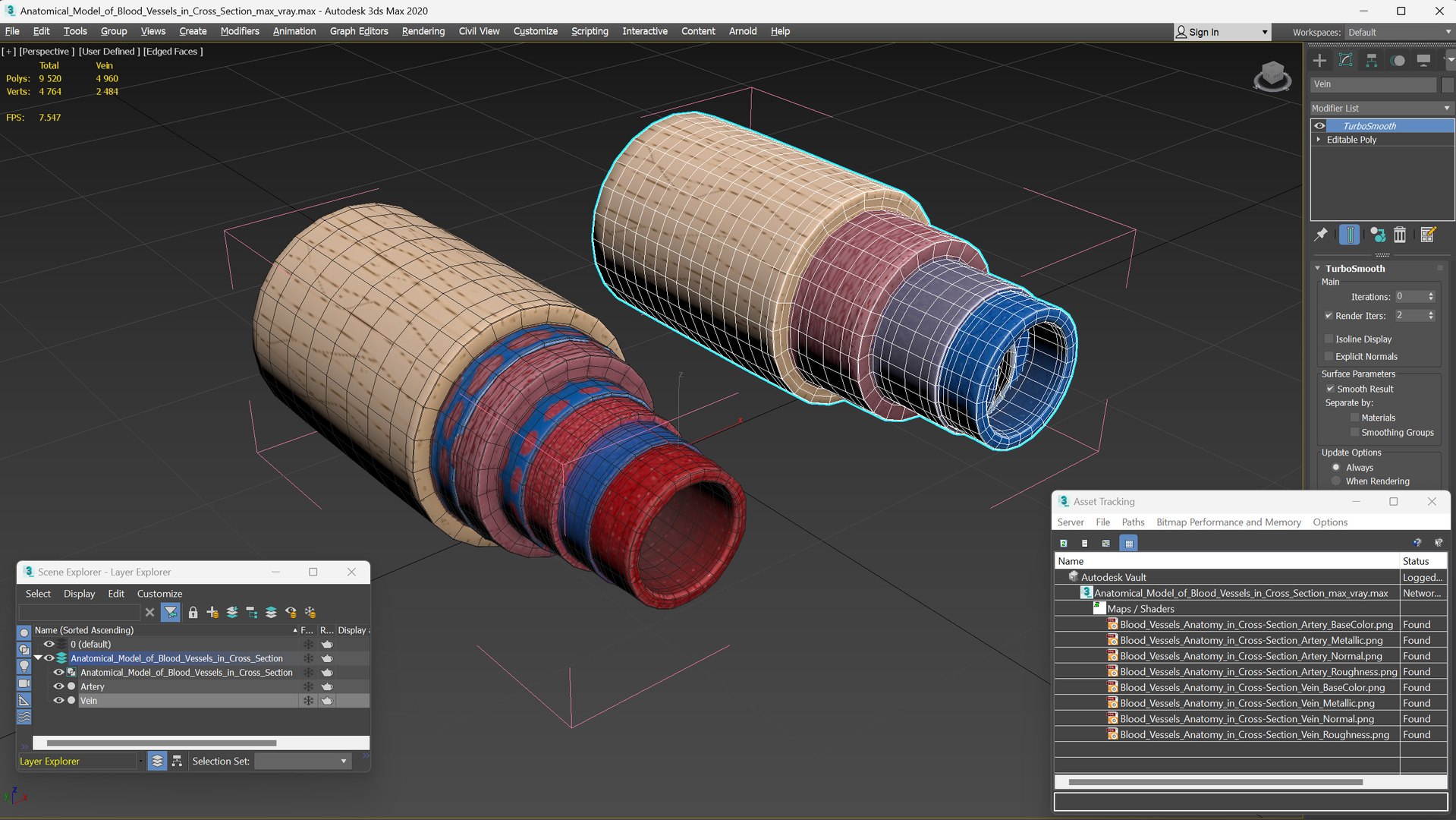 3D Anatomical Model of Blood Vessels in Cross Section https://p.turbosquid.com/ts-thumb/SE/jbQRKY/6N/anatomical_model_of_blood_vessels_in_cross_section_018/jpg/1747065220/1920x1080/fit_q87/ea1c845459b26bb640e37d1d11164e5d5461b1f2/anatomical_model_of_blood_vessels_in_cross_section_018.jpg
