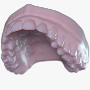 Upper Denture C Mold model