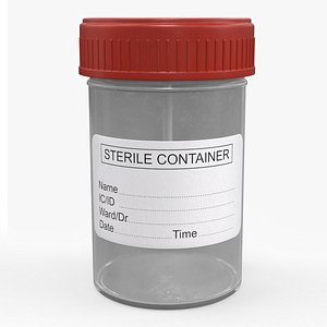 Filled Urine Test Container with Red Lid