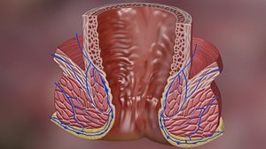 3d max hemorrhoids anal