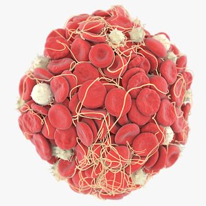 3D Blood Clot model