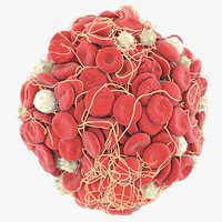 Blood Clot