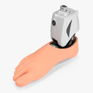 3D Bionic Prosthesis with Rubber Foot