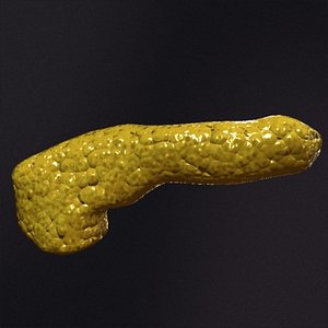 Pancreas
