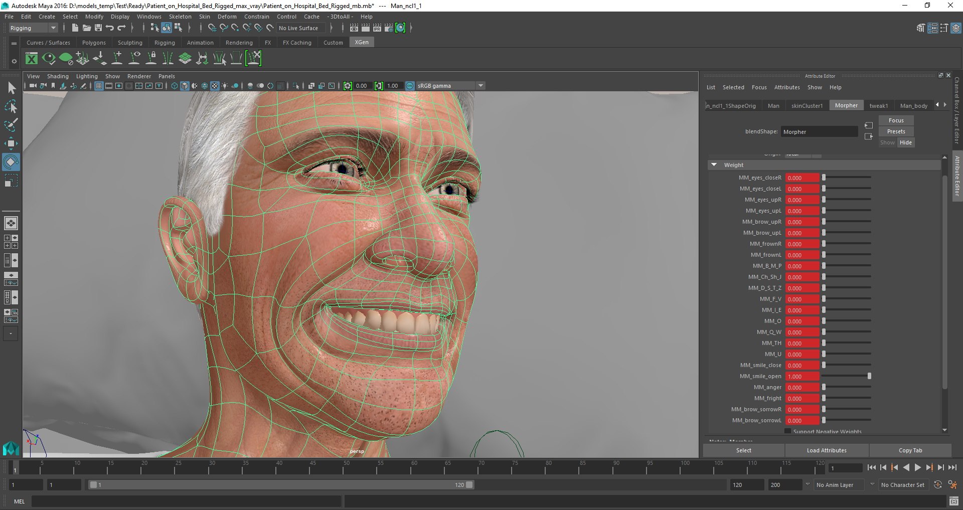 3D model Patient on Hospital Bed Rigged for Maya https://p.turbosquid.com/ts-thumb/Sn/Q4XckB/gP/patient_on_hospital_bed_rigged_mb_07/jpg/1646233949/1920x1080/fit_q87/b22bdc87e9b7e71b5441957234616eb4ed12ea82/patient_on_hospital_bed_rigged_mb_07.jpg