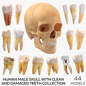 3D model Human Male Skull with Teeth Collection - 44 models