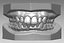 human teeth