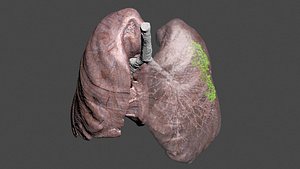 covid lung model