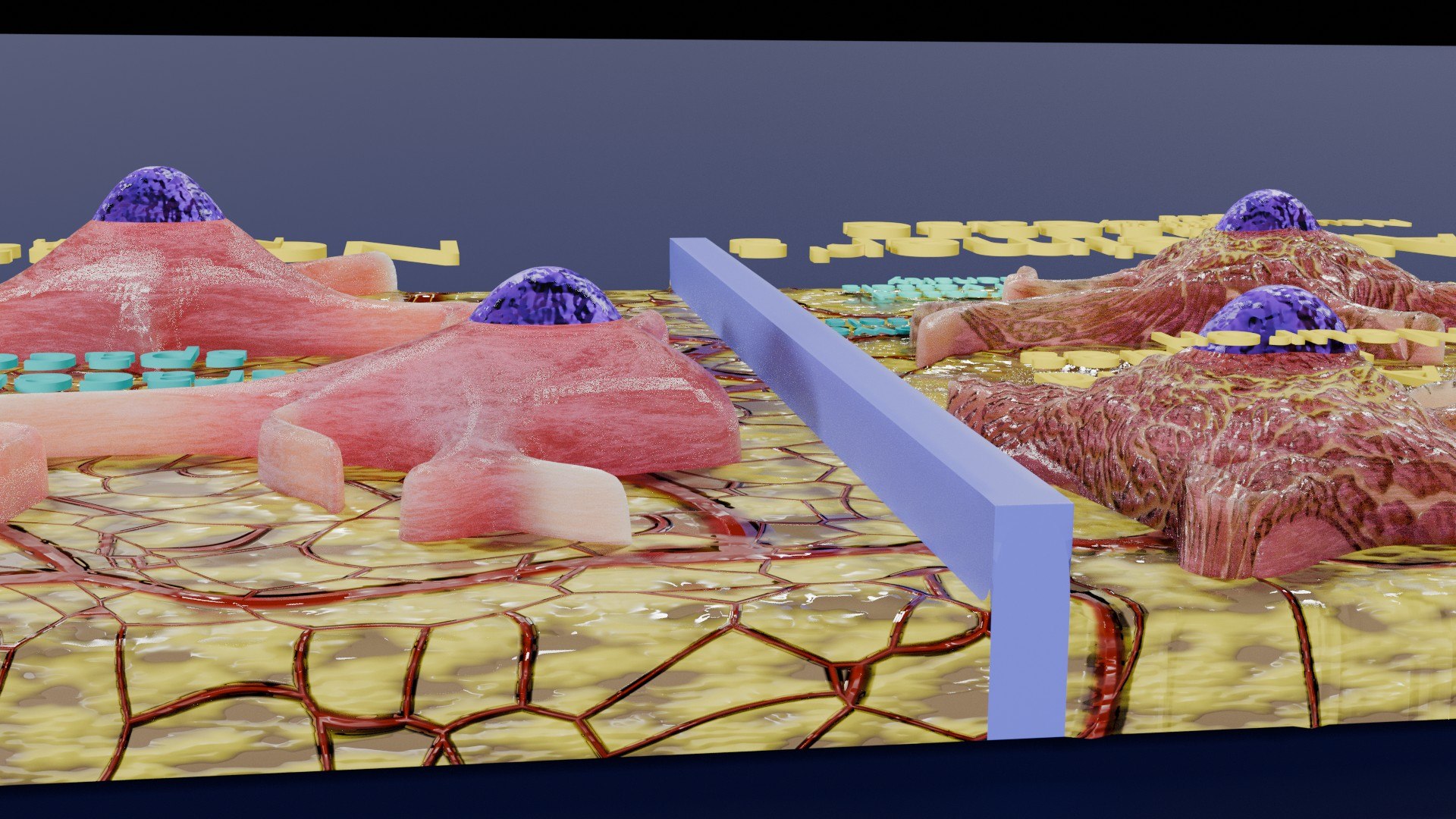 Alzheimer Disease Microscopy Changes Brain Model - TurboSquid 2379501