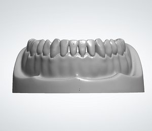 Upper and Lower jaws modeled perfectly - STL 3D