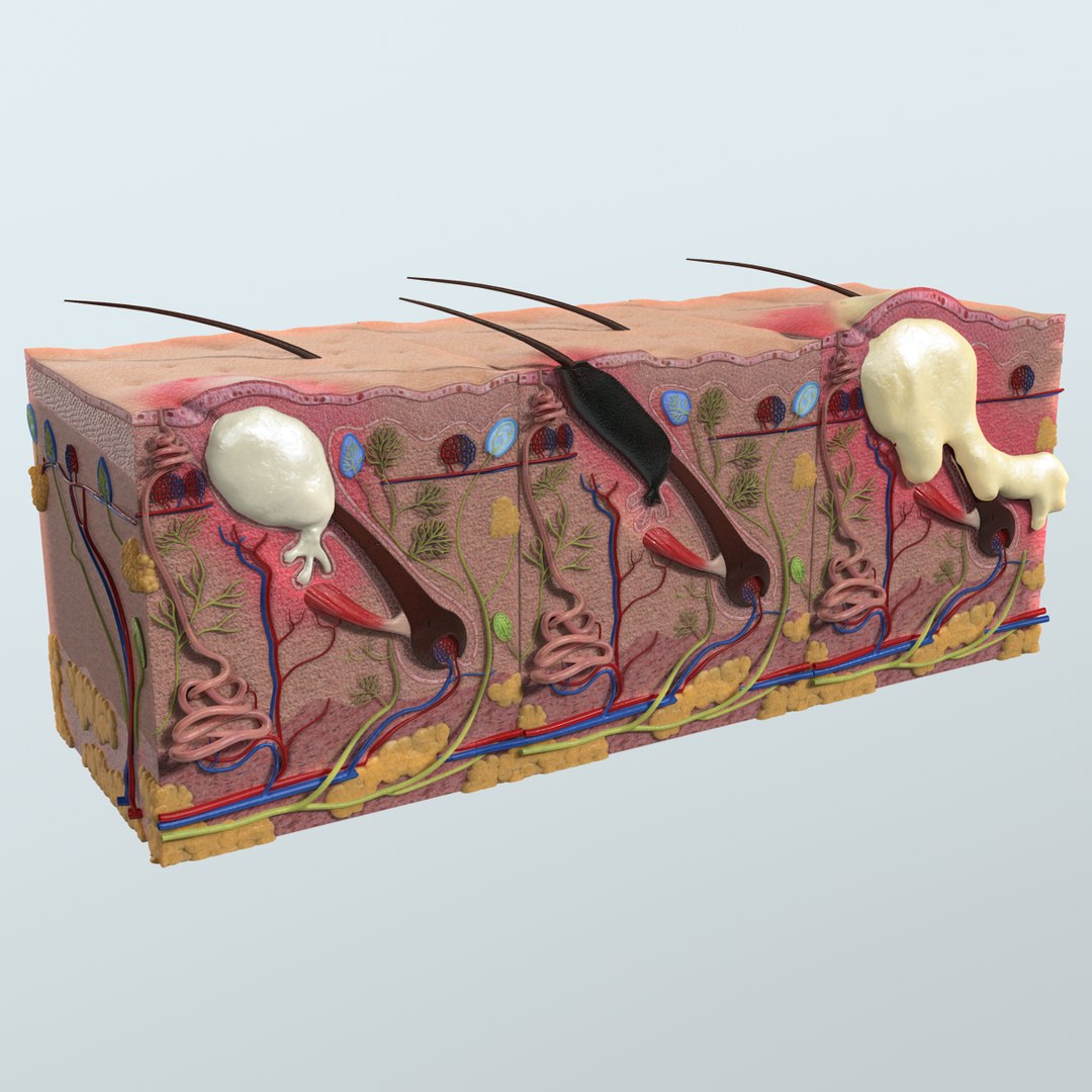 Realistic Skin Acne Anatomy 3D Model - TurboSquid 1164399