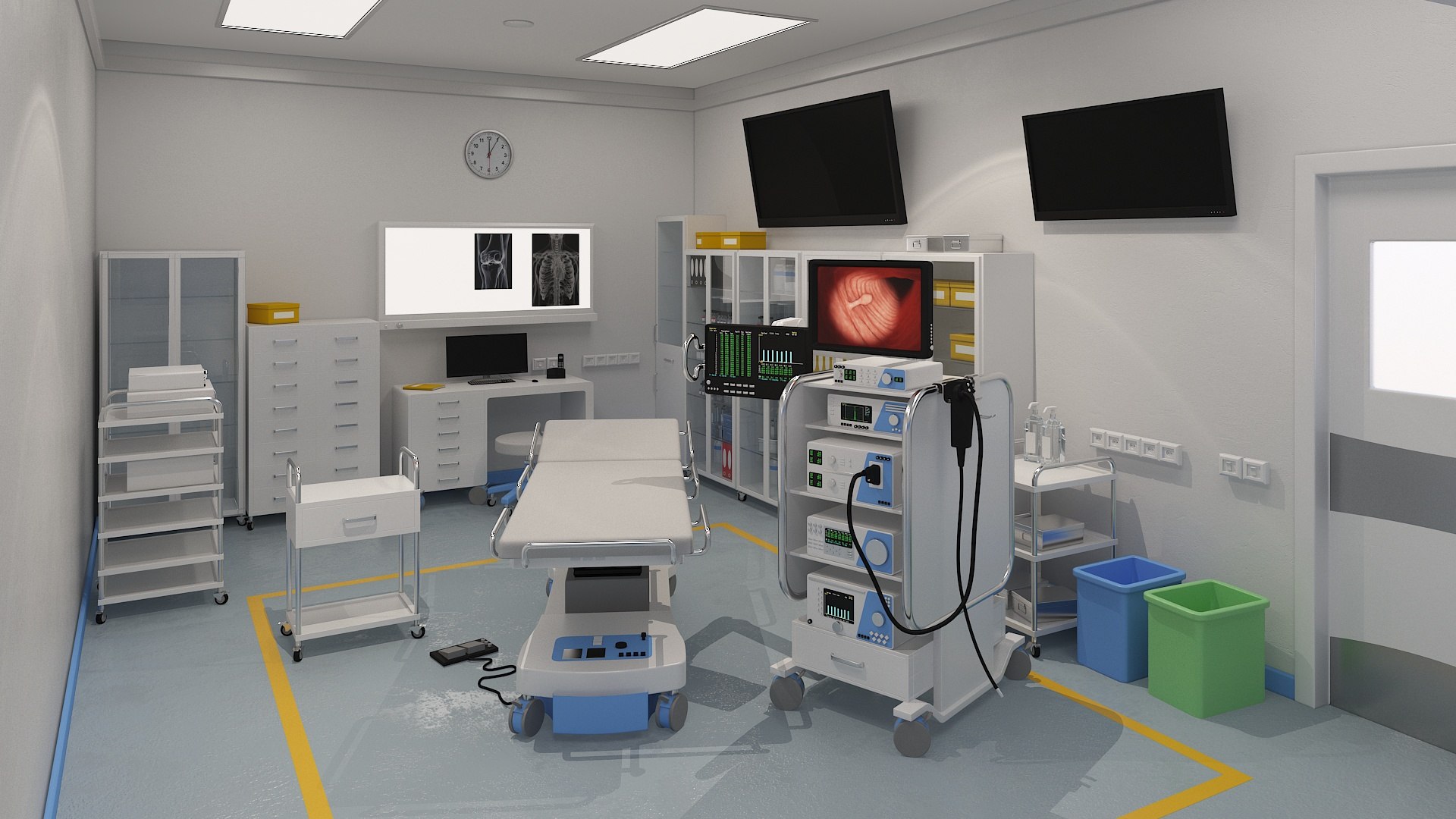 Endoscopy Room 3D https://p.turbosquid.com/ts-thumb/TC/xBYAkr/pF/endoscopy_room_new_0000/jpg/1718258799/1920x1080/fit_q87/0e7a05488f0389df4e2f751a7adf594a3c957c6e/endoscopy_room_new_0000.jpg