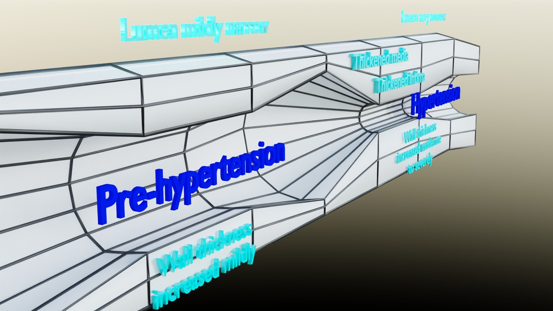 3D Hypertension Blood Vessel Artery Structural Change Model ...