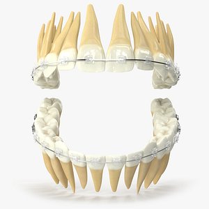 3D Human Teeth With Self Ligating Transparent Dental Braces V02