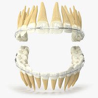 Human Teeth With Self Ligating Transparent Dental Braces V02