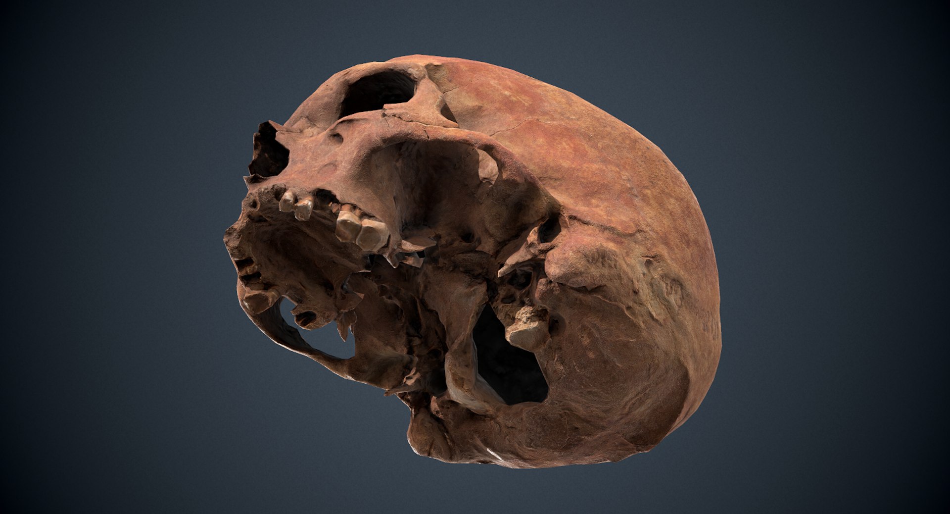 3D real skull model https://p.turbosquid.com/ts-thumb/TV/rfaBVn/2Kbn7CNu/screenshot003/png/1555186661/1920x1080/fit_q87/1c312ce5091bd549046cfe1a0ce1829f7ee11cfb/screenshot003.jpg