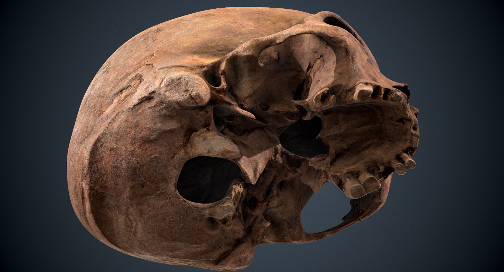 3D real skull model https://p.turbosquid.com/ts-thumb/TV/rfaBVn/4iGD2FMK/screenshot011/png/1555186661/1920x1080/fit_q87/4e42bc8f6cfff5c2e11da4fec53233cdbd3a2bc3/screenshot011.jpg