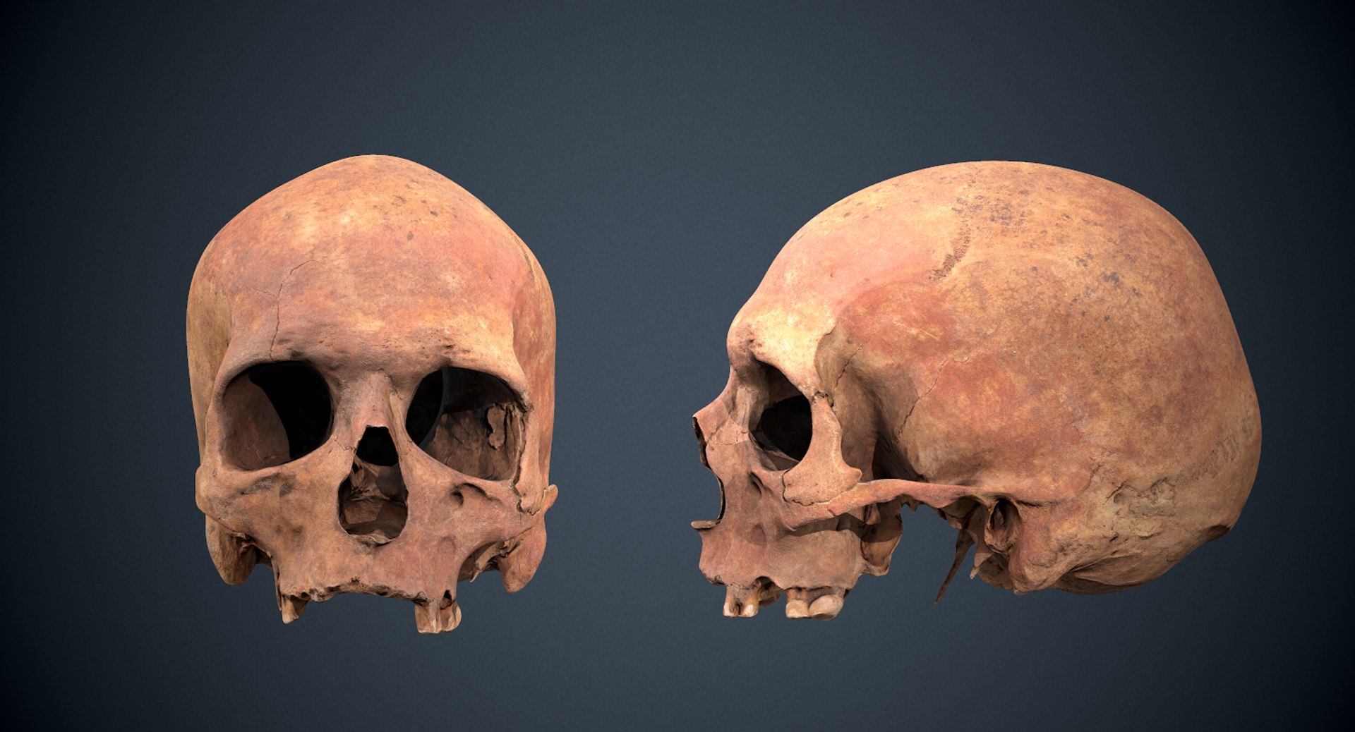 3D real skull model https://p.turbosquid.com/ts-thumb/TV/rfaBVn/iJiVTyfm/screenshot004/png/1555186661/1920x1080/fit_q87/10d0fe691bebbffbdf2cacaa0062c0f8aae1532d/screenshot004.jpg