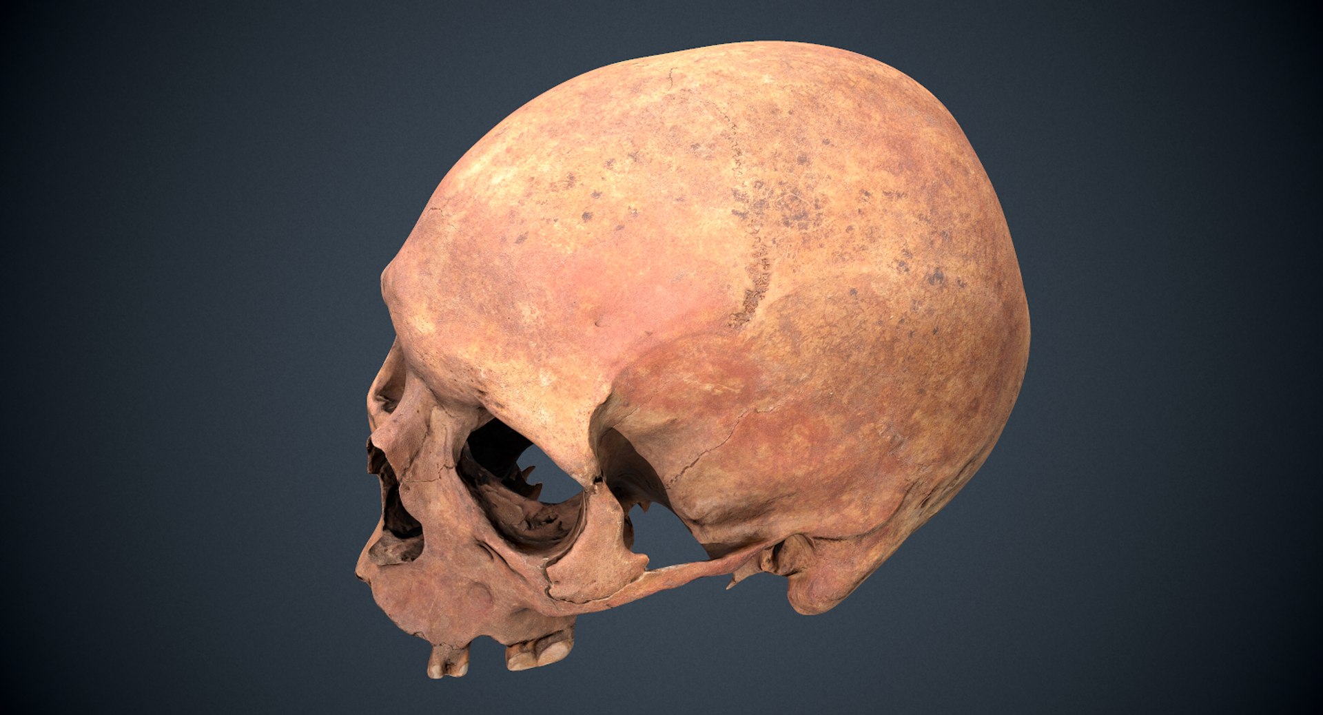3D real skull model https://p.turbosquid.com/ts-thumb/TV/rfaBVn/jWqchPou/screenshot017/png/1555186662/1920x1080/fit_q87/03b6fb34664eae7b582bc98c6dd4d65bf723fa3e/screenshot017.jpg