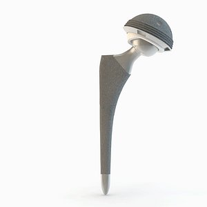 Femoral Prosthesis