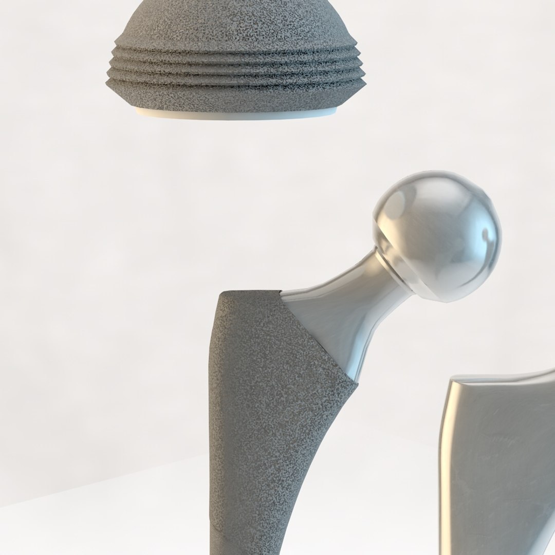 Femoral prosthesis 3D - TurboSquid 1264812