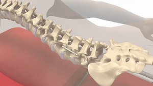 spine human implant 3D model
