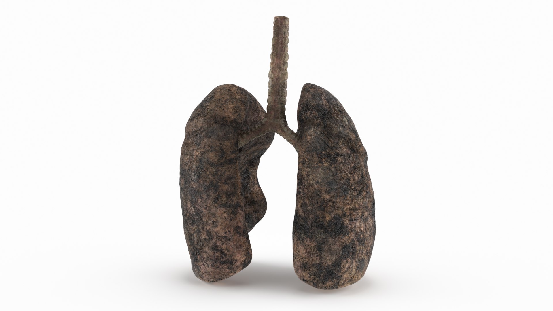 Lung Anatomy Smoker 3D model preview