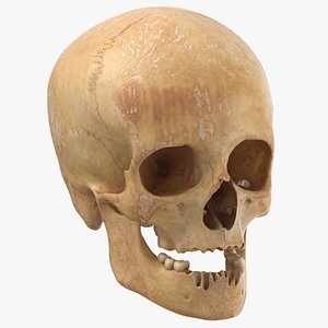 3D human female skull damaged model