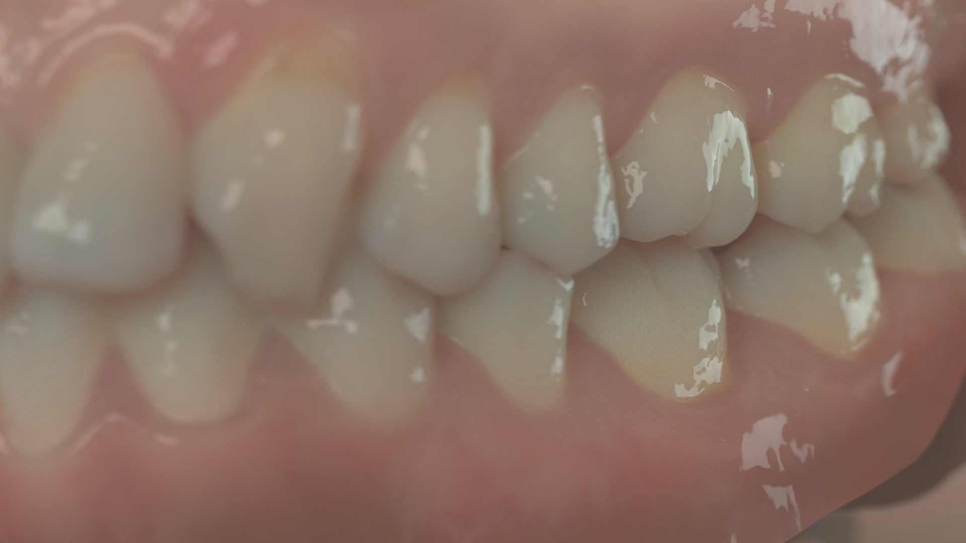 denture medicine anatomy model https://p.turbosquid.com/ts-thumb/Tq/vSwefj/U3/04/jpg/1610417217/1920x1080/fit_q87/028485cc83d5ba12a4732b6ca35cdfba47cc7078/04.jpg
