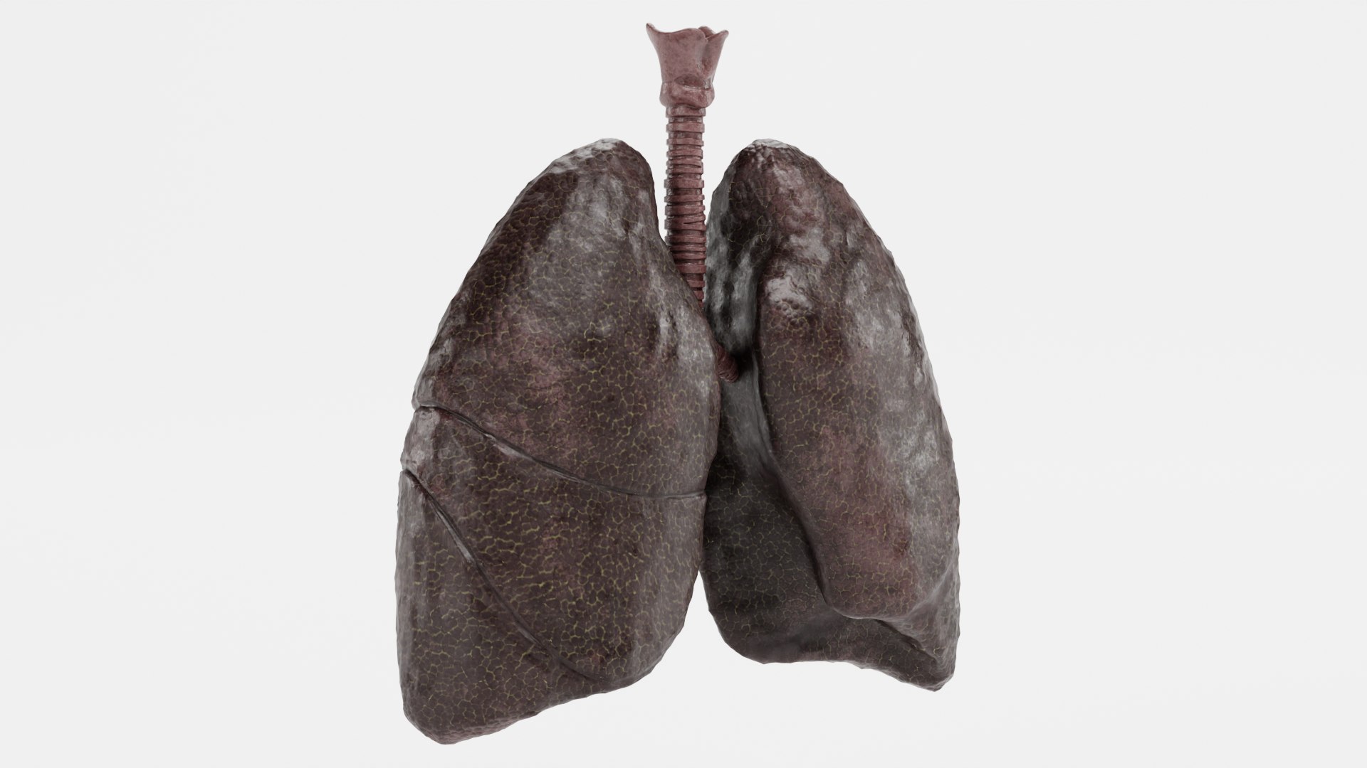 Smoker Lungs 3d Model - Turbosquid 1839098