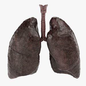 Smoker Lungs 3D model