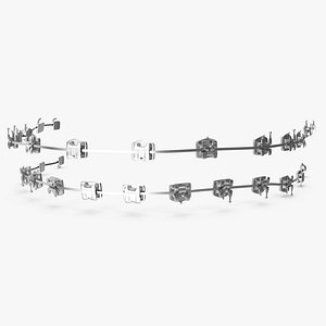 Self Ligating Steel Dental Braces V03