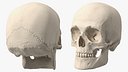 Male Human Skull