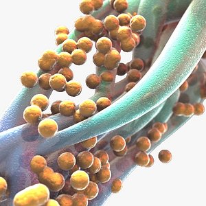 Staphylococcus (MRSA)